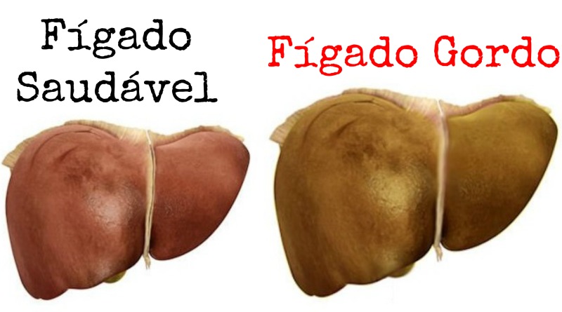 figor1