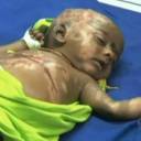 Bebê de trÊs meses causa polêmica na Índia por supostamente pegar fogo sozinho