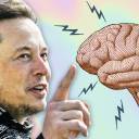 Especialistas estão soando alarmes sobre os implantes cerebrais de Elon Musk