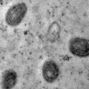 Vírus Monkeypox pode se tornar uma nova DST nos EUA