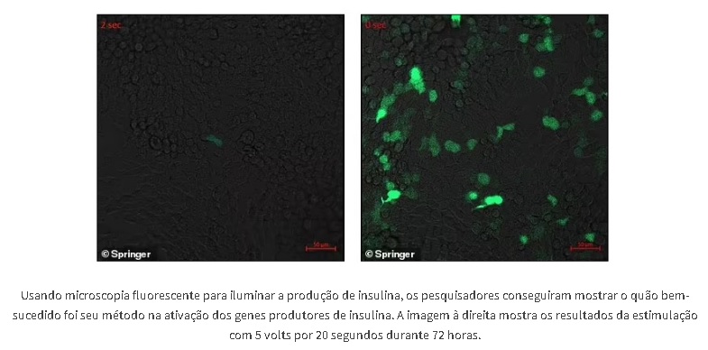 Eletricidade gene insulina