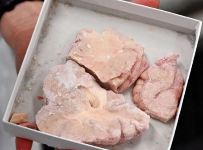 Cérebros Humanos congelados