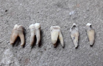Tuneis ibiruba dentes