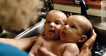 Gêmeas siamesas Abigail Brittney bebes