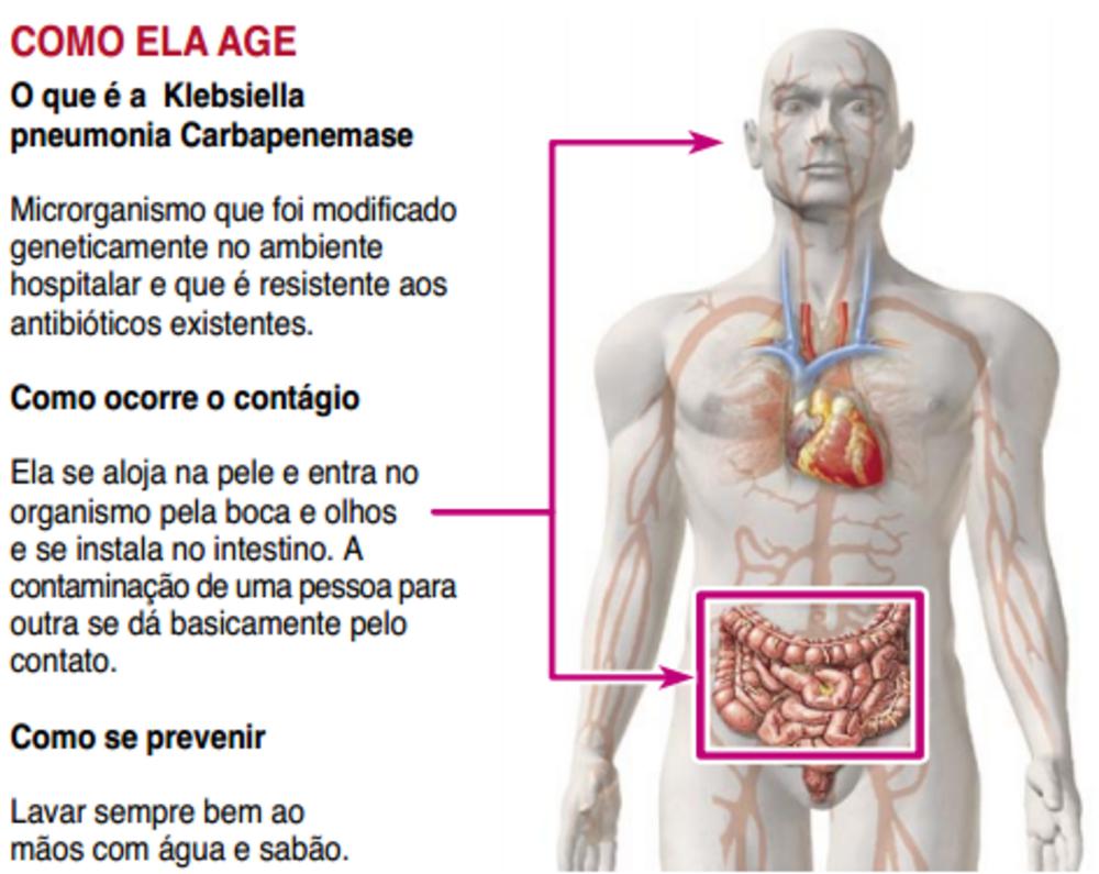 auperba1