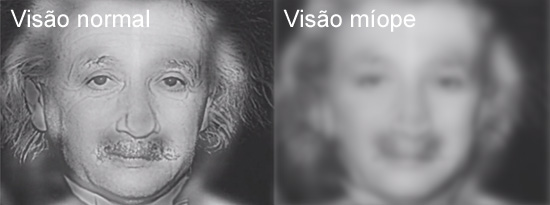 miovis2