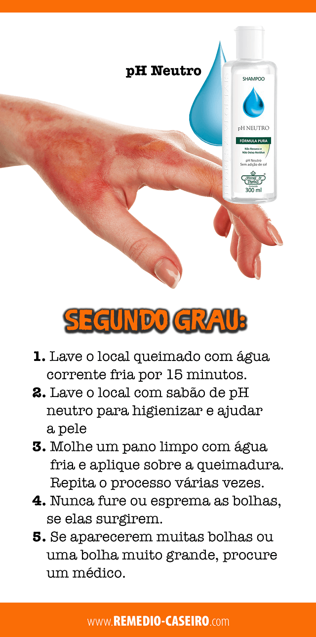 pomquei5