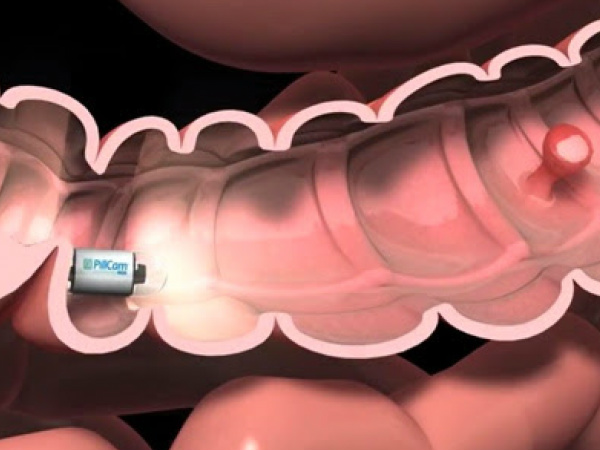 tecnova5