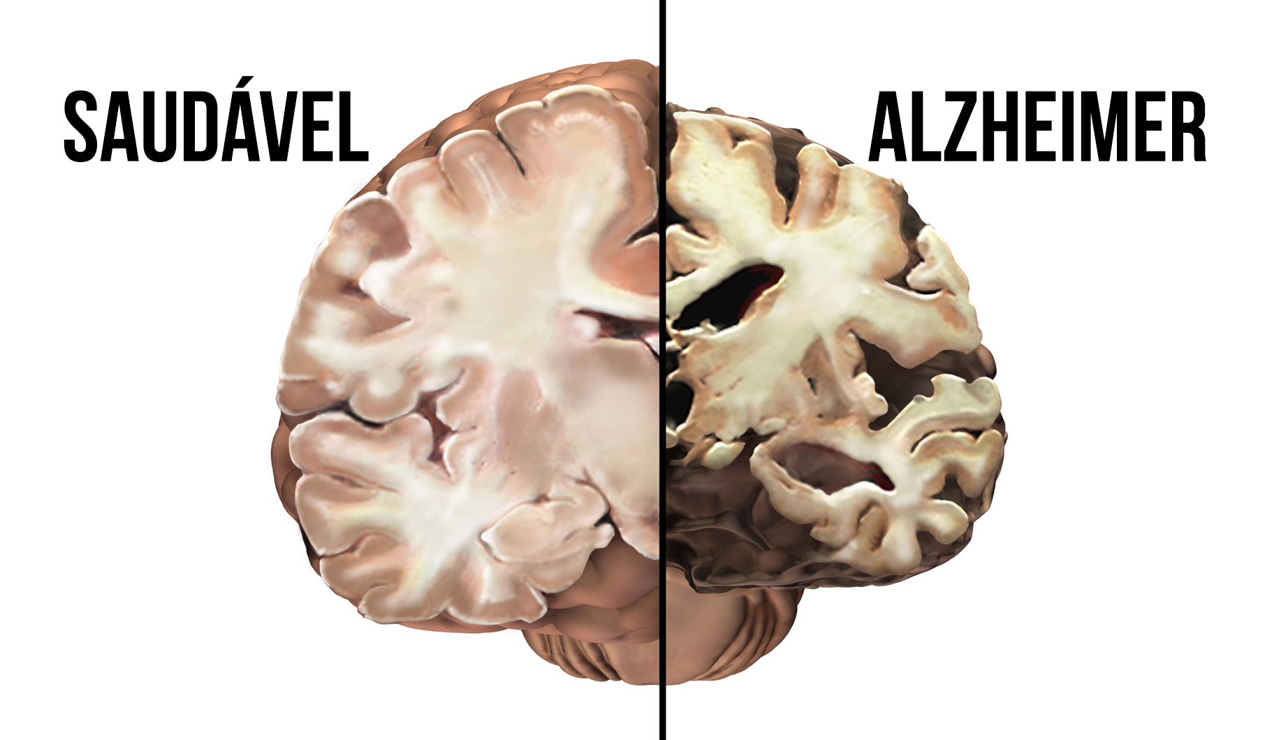 alza2