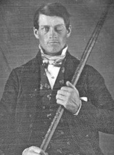 7_phineas_gage