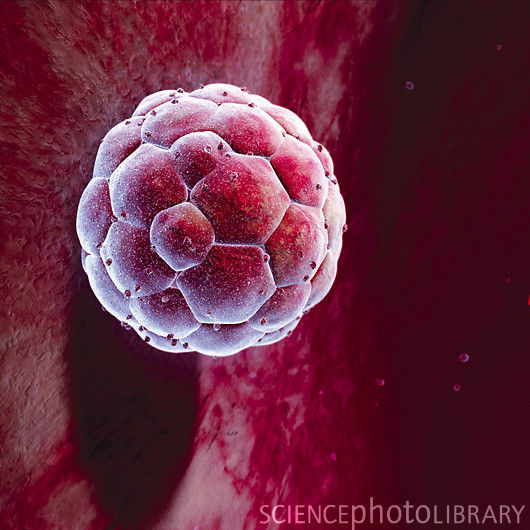 P6800679-Human blastocyst-SPL