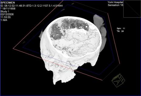 cerebro2500_1