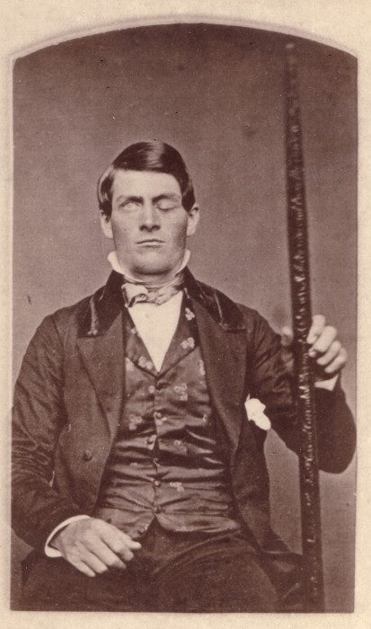 Phineas Gage 1