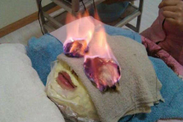 Fogo terapia rosto