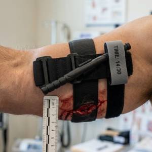 Torniquete: O Freio de Emergência Que Salva Vidas